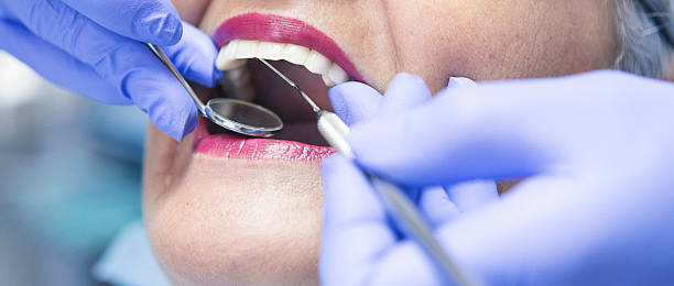 Best Emergency Treatment for Dental Infections or Abscesses in Bonne Terre, MO